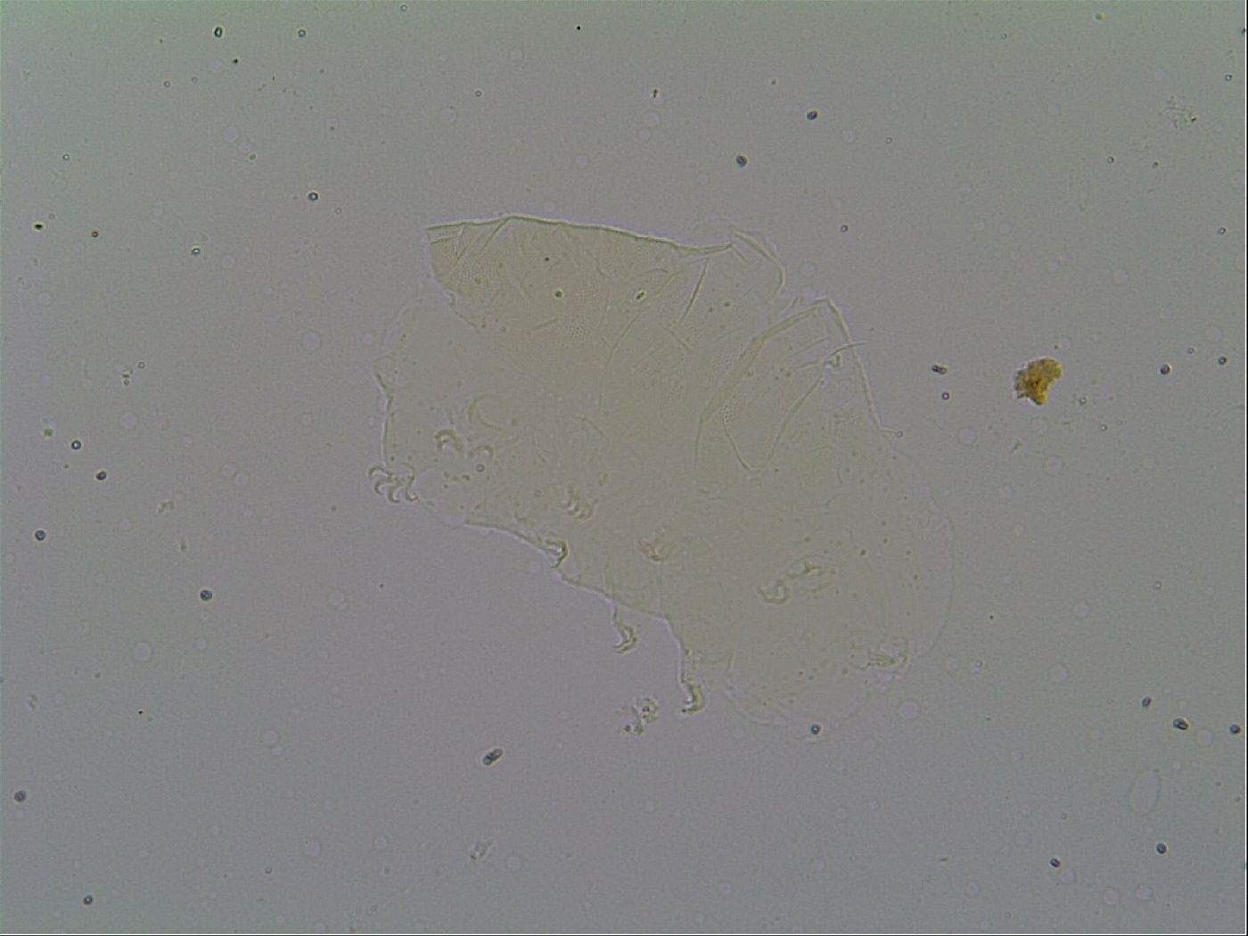 Pseudechiniscus suillus image