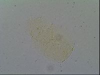 Pseudechiniscus suillus image