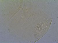 Pseudechiniscus suillus image
