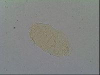 Pseudechiniscus suillus image