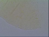 Pseudechiniscus suillus image