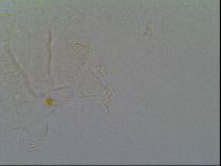 Pseudechiniscus suillus image