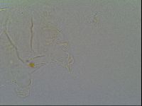 Pseudechiniscus suillus image