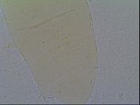 Pseudechiniscus suillus image