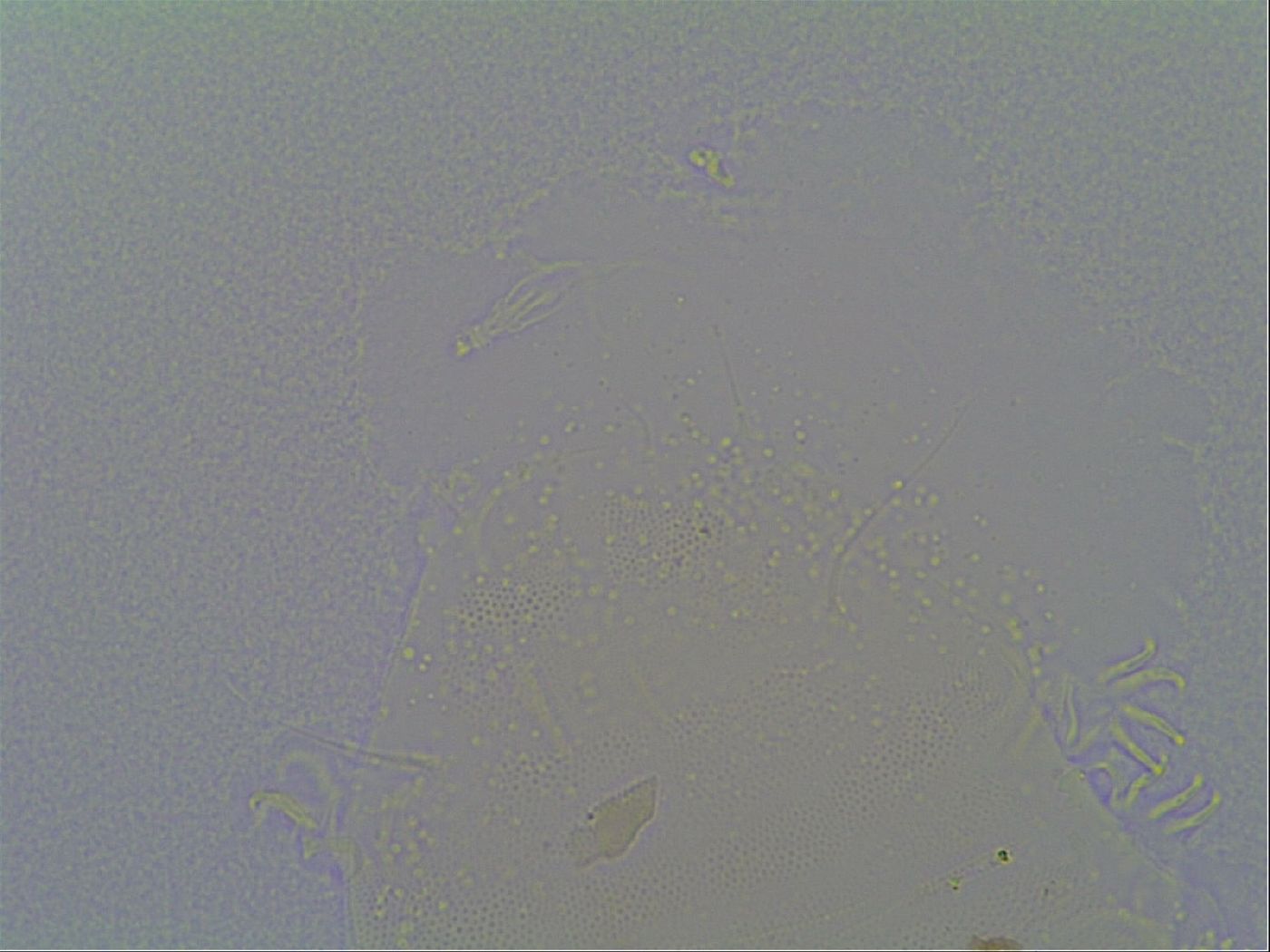 Pseudechiniscus suillus image