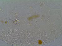 Pseudechiniscus suillus image