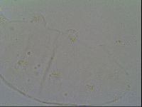 Pseudechiniscus suillus image