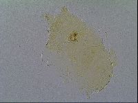 Pseudechiniscus suillus image