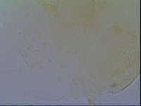 Pseudechiniscus suillus image