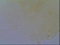 Pseudechiniscus suillus image