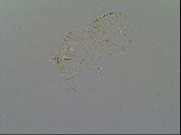 Pseudechiniscus suillus image
