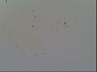 Pseudechiniscus suillus image