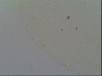 Pseudechiniscus suillus image