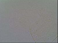 Pseudechiniscus suillus image