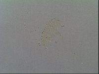 Multipseudechiniscus raneyi image