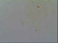 Multipseudechiniscus raneyi image
