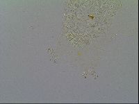 Multipseudechiniscus raneyi image