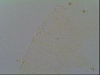 Multipseudechiniscus raneyi image