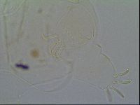 Multipseudechiniscus raneyi image