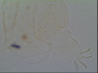 Multipseudechiniscus raneyi image