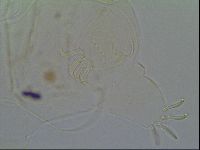 Multipseudechiniscus raneyi image