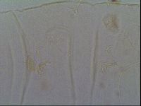 Multipseudechiniscus raneyi image