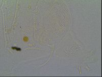 Multipseudechiniscus raneyi image