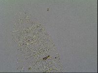 Multipseudechiniscus raneyi image