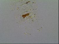 Multipseudechiniscus raneyi image