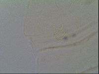 Multipseudechiniscus raneyi image