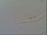 Multipseudechiniscus raneyi image