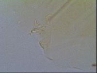 Multipseudechiniscus raneyi image
