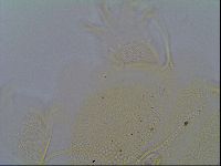Multipseudechiniscus raneyi image