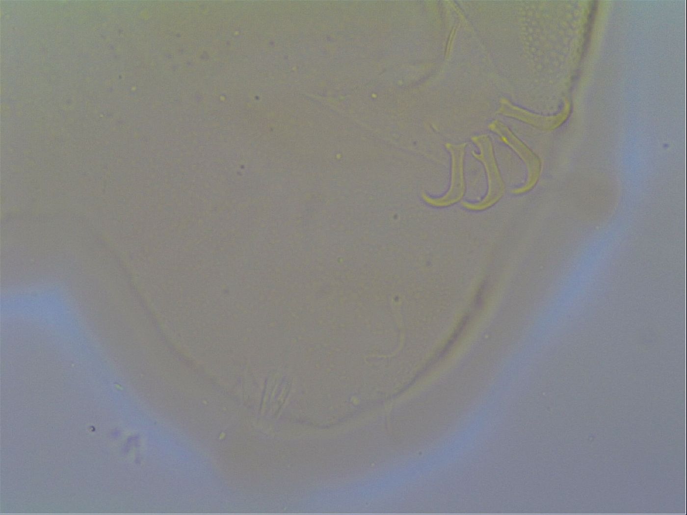 Multipseudechiniscus raneyi image