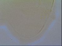 Multipseudechiniscus raneyi image