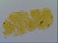 Multipseudechiniscus raneyi image