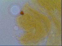 Multipseudechiniscus raneyi image