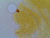 Multipseudechiniscus raneyi image