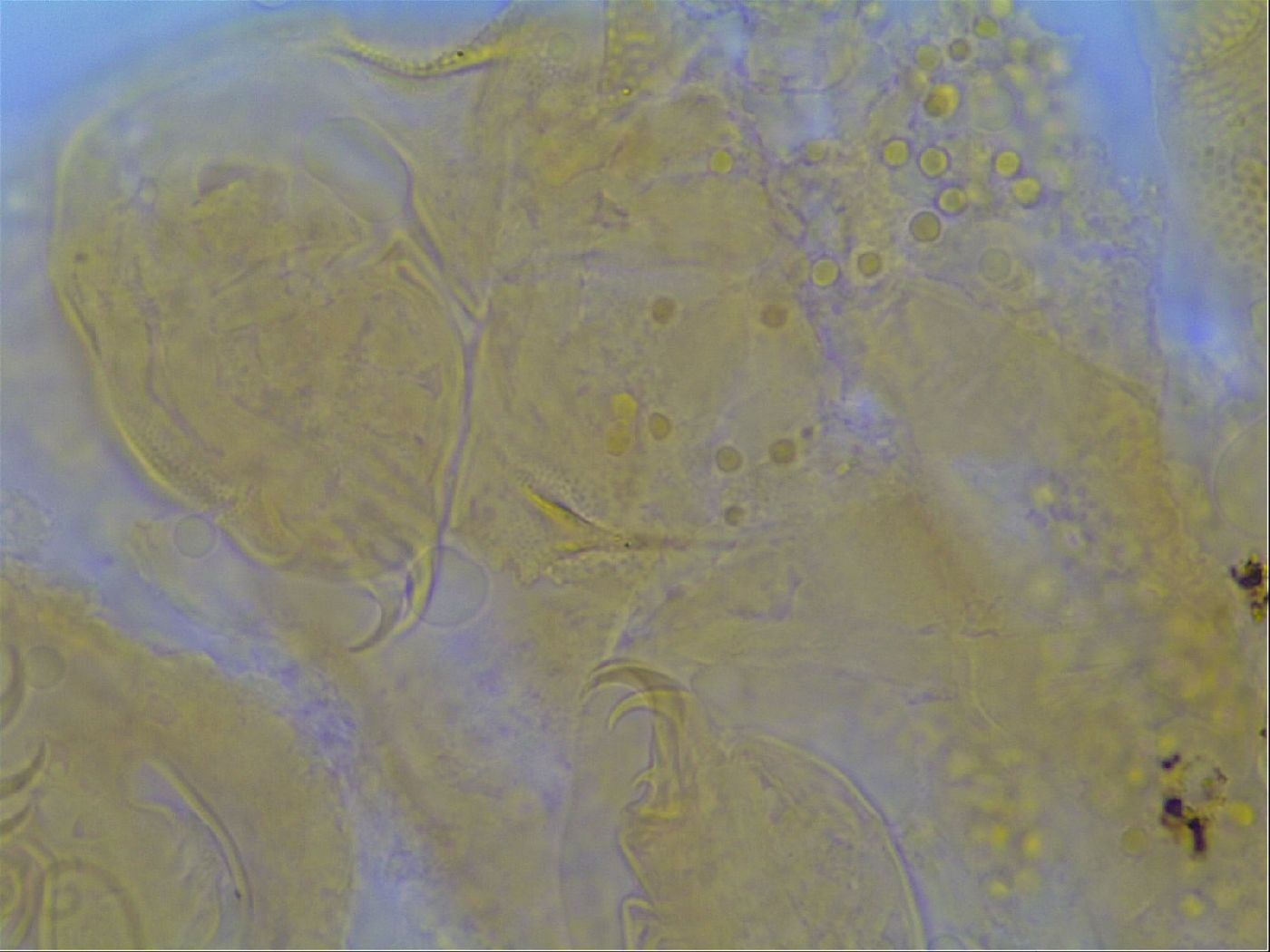 Multipseudechiniscus raneyi image