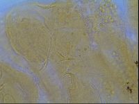Media resource of Multipseudechiniscus raneyi