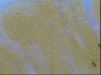 Multipseudechiniscus raneyi image
