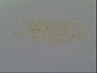 Pseudechiniscus ramazzottii image
