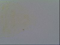Pseudechiniscus ramazzottii image