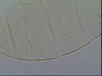 Pseudechiniscus ramazzottii image