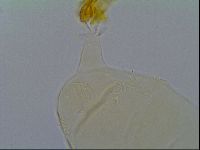 Pseudechiniscus ramazzottii image
