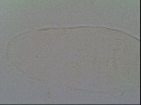 Pseudechiniscus ramazzottii image