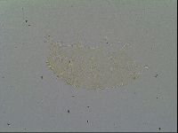 Pseudechiniscus suillus image