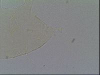 Pseudechiniscus suillus image