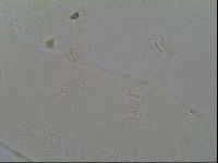 Pseudechiniscus ramazzottii image