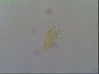 Multipseudechiniscus raneyi image